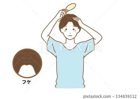 患有頭皮屑的男子 患有頭皮屑的男子 134839112