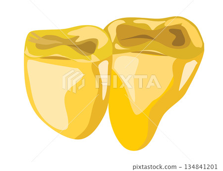 gold tooth illustration gold tooth illustration 134841201