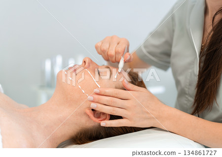 Dermatologist applying cream on the face of a 134861727