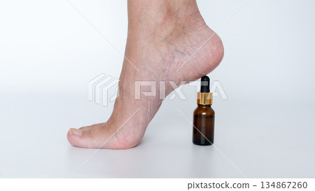 Sore, tired foot resting on a small amber bottle, showcasing the struggle of heavy legs and the need for relief and relaxation 134867260