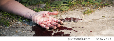 A man's hand in blood lies on the ground 134877573