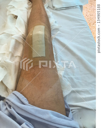 A man's leg is wrapped in bandages A man's leg is wrapped in bandages 134905188