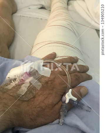 A man's hand is wrapped in gauze and a tube is attached to it 134905210