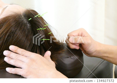 Painless beauty chiropractic acupuncture treatment for the head Painless beauty chiropractic acupuncture treatment for the head 134927372