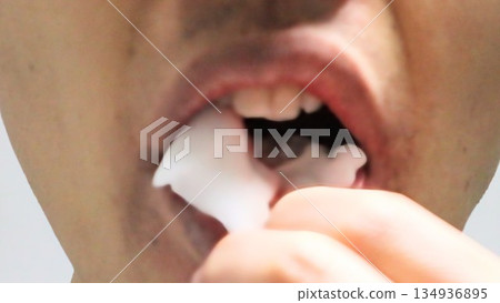 拔除智齒後，有人正在移除紗布。 134936895