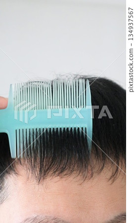 一位頭髮稀疏的日本男子正在梳頭。 134937567