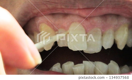 一個人用牙籤清潔牙齒間的縫隙。 134937568