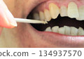 A person cleaning the gaps between their teeth with a toothpick 134937570