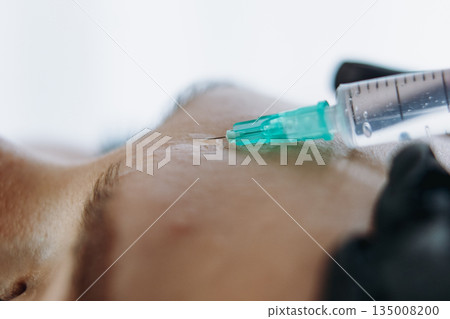 close up of professional hands making a rejuvenation injection into woman frown line close up of professional hands making a rejuvenation injection into woman frown line 135008200