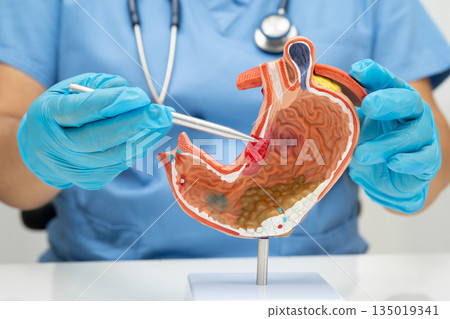 Stomach disease, doctor holding anatomy model for study diagnosis and treatment in hospital. Stomach disease, doctor holding anatomy model for study diagnosis and treatment in hospital. 135019341