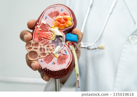 Cardiovascular disease CVD, Asian doctor holding human anatomy model for learn and treat heart disease. 135019618