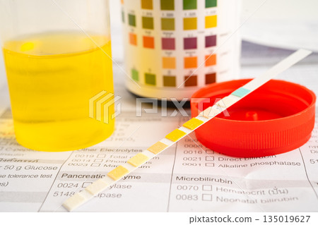 Urinalysis, urine cup with reagent strip pH paper test and comparison chart in laboratory. 135019627