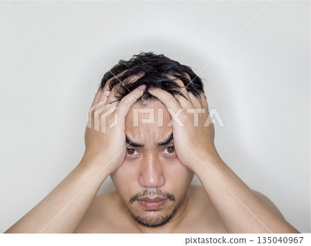 An Asian man with a stressed expression holding his head, representing anxiety or a migraine. An Asian man with a stressed expression holding his head, representing anxiety or a migraine. 135040967