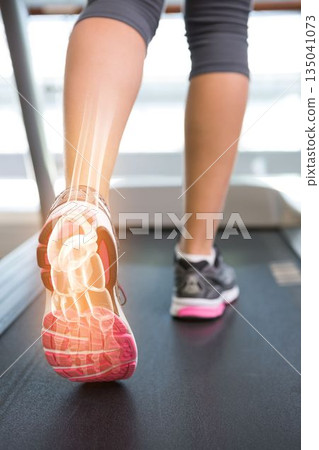 Jogger experiencing ankle pain 135041073