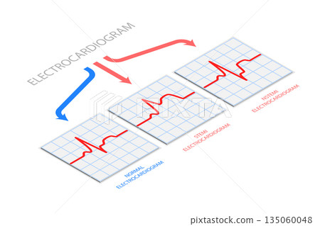 3D Isometric Flat  Illustration of Electrocardiogram, Diagnostics and Healthcare 135060048