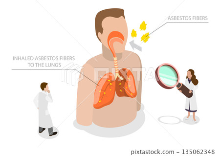 3D Isometric Flat  Illustration of Asbestos, Symptoms Of Asbestos Exposure, Chest Pain, Swollen Testes, And Scrotum, Fluid In Chest 135062348