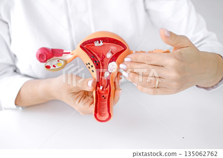 A gynecologist demonstrates neoplasms on a model of a female uterus to interns and students. Women's diseases. World Cancer Day A gynecologist demonstrates neoplasms on a model of a female uterus to interns and students. Women's diseases. World Cancer Day 135062762