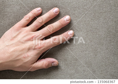 Close-up of male masculine hand with rough skin and short fingernails resting on flat copy space background, top view. Manual labor and hands care concept. 135068367