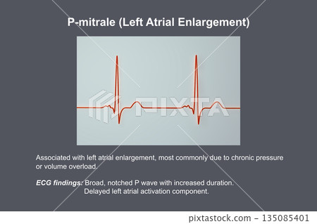 P-mitrale, 3D illustration P-mitrale, 3D illustration 135085401