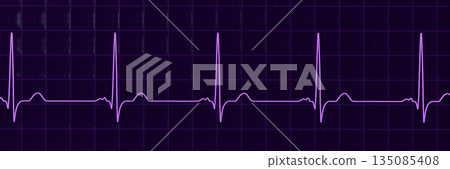 P-mitrale, 3D illustration P-mitrale, 3D illustration 135085408