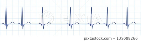 Respiratory sinus arrhythmia, 3D illustration 135089266