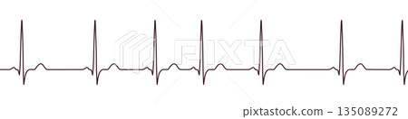 Respiratory sinus arrhythmia, 3D illustration Respiratory sinus arrhythmia, 3D illustration 135089272
