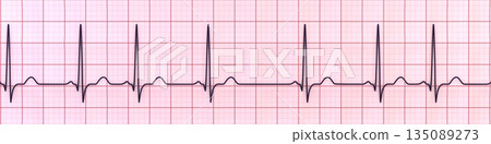 Respiratory sinus arrhythmia, 3D illustration Respiratory sinus arrhythmia, 3D illustration 135089273