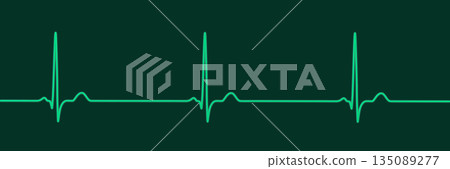 Sinus bradycardia, 3D illustration Sinus bradycardia, 3D illustration 135089277