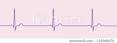 Sinus bradycardia, 3D illustration Sinus bradycardia, 3D illustration 135089278