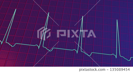 Left ventricular hypertrophy, 3D illustration 135089454
