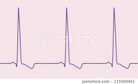 Left ventricular hypertrophy, 3D illustration 135089462
