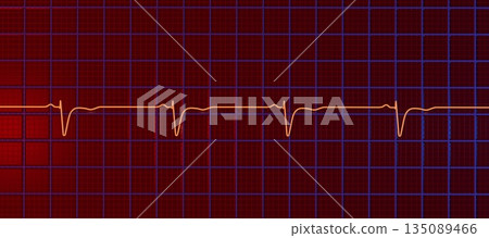 Normal ECG in V1-V2, 3D illustration Normal ECG in V1-V2, 3D illustration 135089466