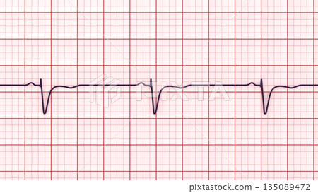Normal ECG in V1-V2, 3D illustration 135089472