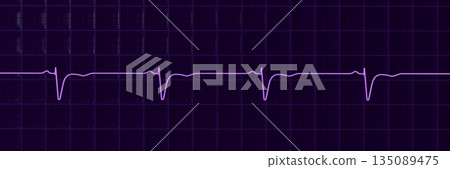 Normal ECG in V1-V2, 3D illustration 135089475