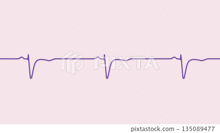 Normal ECG in V1-V2, 3D illustration Normal ECG in V1-V2, 3D illustration 135089477