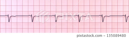 Normal ECG in V1-V2, 3D illustration 135089480