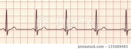 Normal ECG, 3D illustration Normal ECG, 3D illustration 135089483