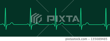 Normal ECG, 3D illustration 135089485
