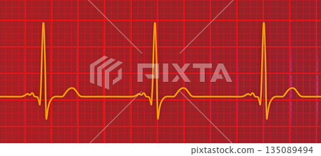 P-mitrale, 3D illustration 135089494