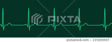 P-mitrale, 3D illustration P-mitrale, 3D illustration 135089497
