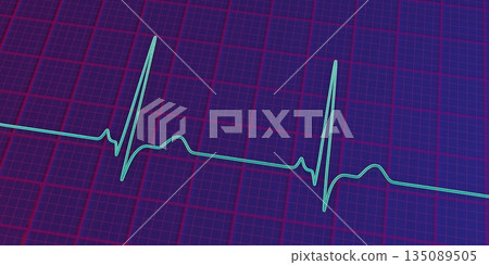 P-pulmonale, 3D illustration P-pulmonale, 3D illustration 135089505