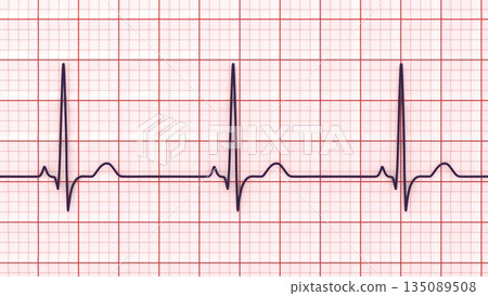 P-pulmonale, 3D illustration P-pulmonale, 3D illustration 135089508