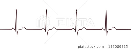 P-pulmonale, 3D illustration P-pulmonale, 3D illustration 135089515