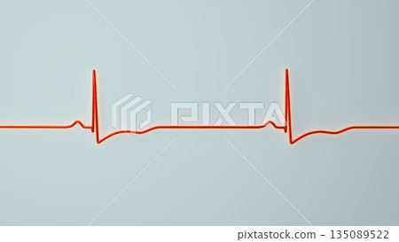 Right ventricular hypertrophy, 3D illustration Right ventricular hypertrophy, 3D illustration 135089522