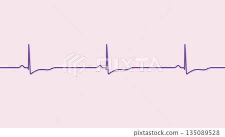 Right ventricular hypertrophy, 3D illustration 135089528