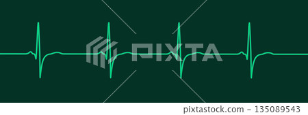 Right ventricular hypertrophy, 3D illustration Right ventricular hypertrophy, 3D illustration 135089543