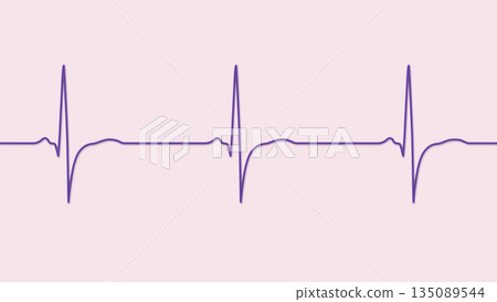 Right ventricular hypertrophy, 3D illustration 135089544