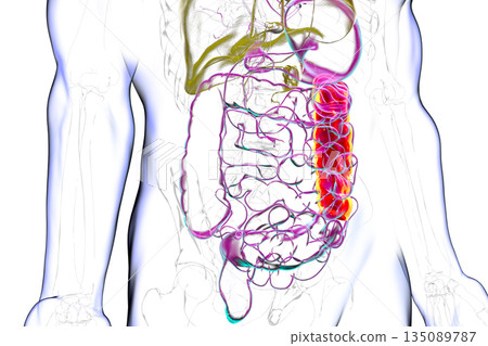 Human digestive system with highlighted descending colon, 3D illustration Human digestive system with highlighted descending colon, 3D illustration 135089787