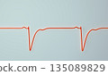 Left ventricular hypertrophy, 3D illustration 135089829