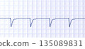 Left ventricular hypertrophy, 3D illustration 135089831